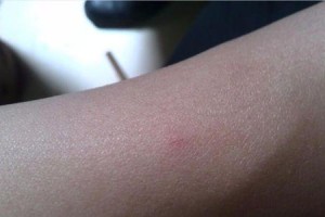 狗狗疫苗症状探究（了解狗狗疫苗的正常反应和异常症状，关注健康一步不可少）