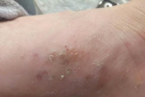 脚发抖是什么病？（了解脚发抖的原因和治疗方法）