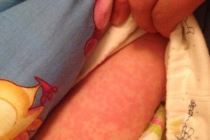 打针后多久洗澡合适？（洗澡时间的选择对健康的影响）