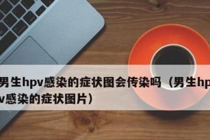 犬六联高免血清过敏症状及应对措施（了解犬六联高免血清过敏的常见症状与治疗方法）