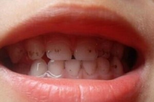 土狗换牙期详解（了解土狗什么时候开始换牙以及如何照顾他们的口腔健康）
