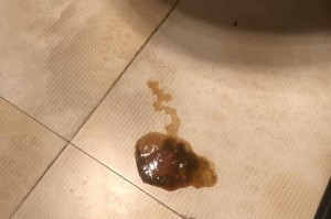狗狗拉稀和出血的原因（探索造成狗狗拉稀和出血的常见原因）
