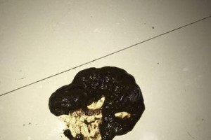 金毛拉什么便便好？（探究金毛犬犬主们关心的排便问题）
