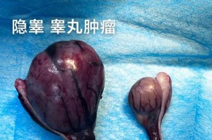猫隐睾手术的最佳时机及注意事项（解决猫咪健康问题的关键——隐睾手术）