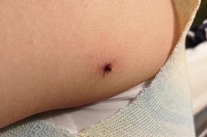 猫咪驱虫后一直翻滚怎么办？（如何缓解猫咪驱虫后的症状？）