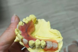 狗的牙齿残缺之谜（探究狗牙齿残缺的原因与解决方法）