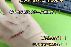 狗发作狂犬病的症状及预防措施（了解狂犬病的症状，保护宠物和自己的安全）