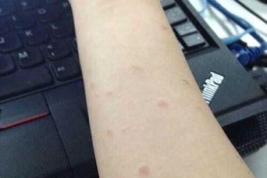 家猫常见传染病及预防措施（了解家猫传染病，保护您的爱宠健康）