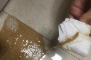 细小后遗症（揭开细小后遗症的神秘面纱，了解其症状和应对策略）
